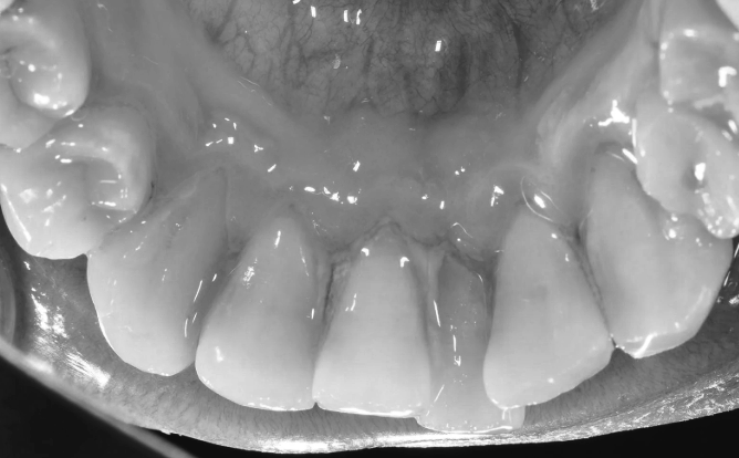 치아틀어짐 방치하면 생기는 문제점 의사가 경고하는 이유 관련 이미지 4