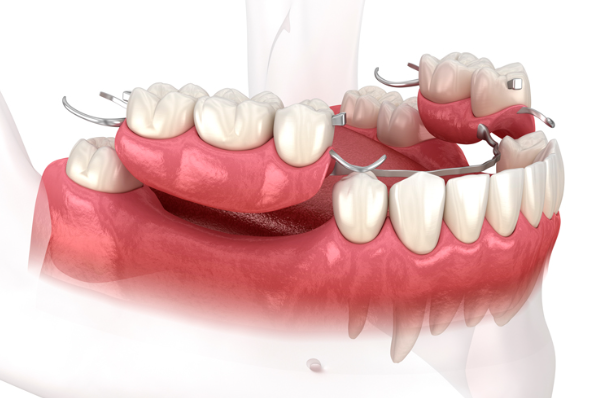 선릉역치아미백, 후기보다 먼저봐야 할 것이 있습니다 관련 이미지 6