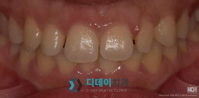 라미네이트종류, 이것만 확인하면 됩니다 관련 이미지 6