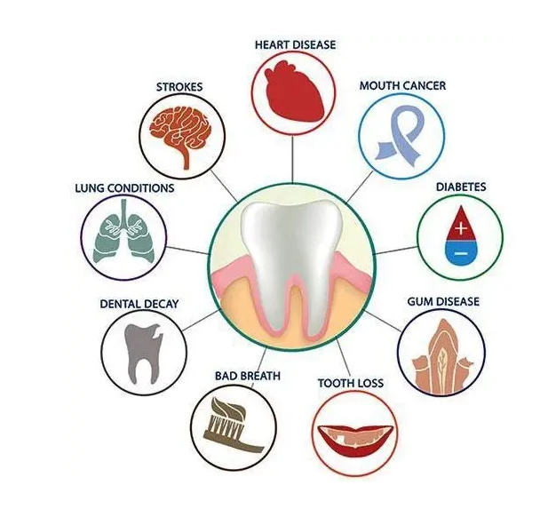 잇몸 부으면 치석 때문? 치아 흔들림의 이유 관련 이미지 6