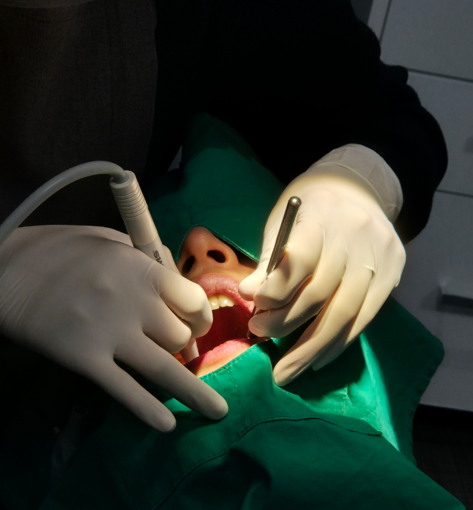 치아미백시술비용, 저렴하면 위험한 2가지 이유 관련 이미지 7