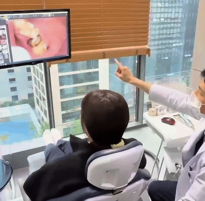 아랫니충치, 치료 미루면 안 되는 이유 2가지 관련 이미지 3