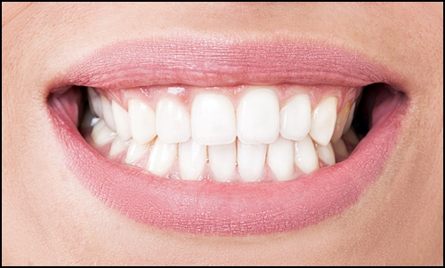 앞니 임플란트 임시치아, 수술 전 꼭 알아야 하는 관련 이미지 1