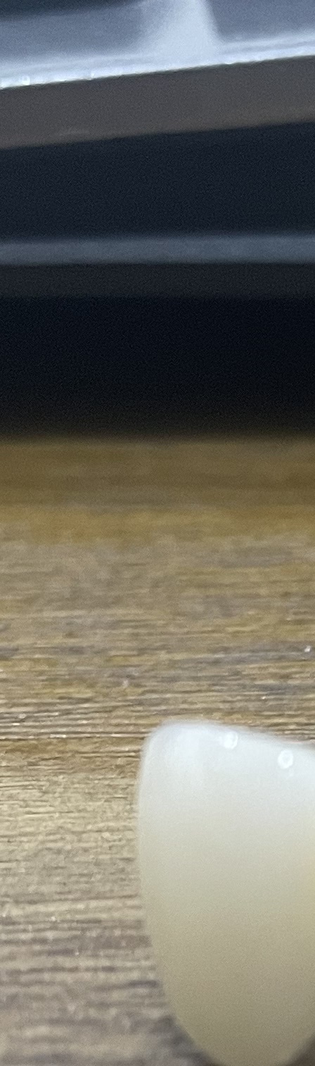 서초동 치과, 통증이 두려워 방문을 꺼리신다면? 관련 이미지 6