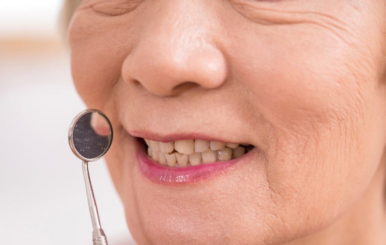 고령자임플란트 보험 적용받을 때 주의할 점 관련 이미지 2