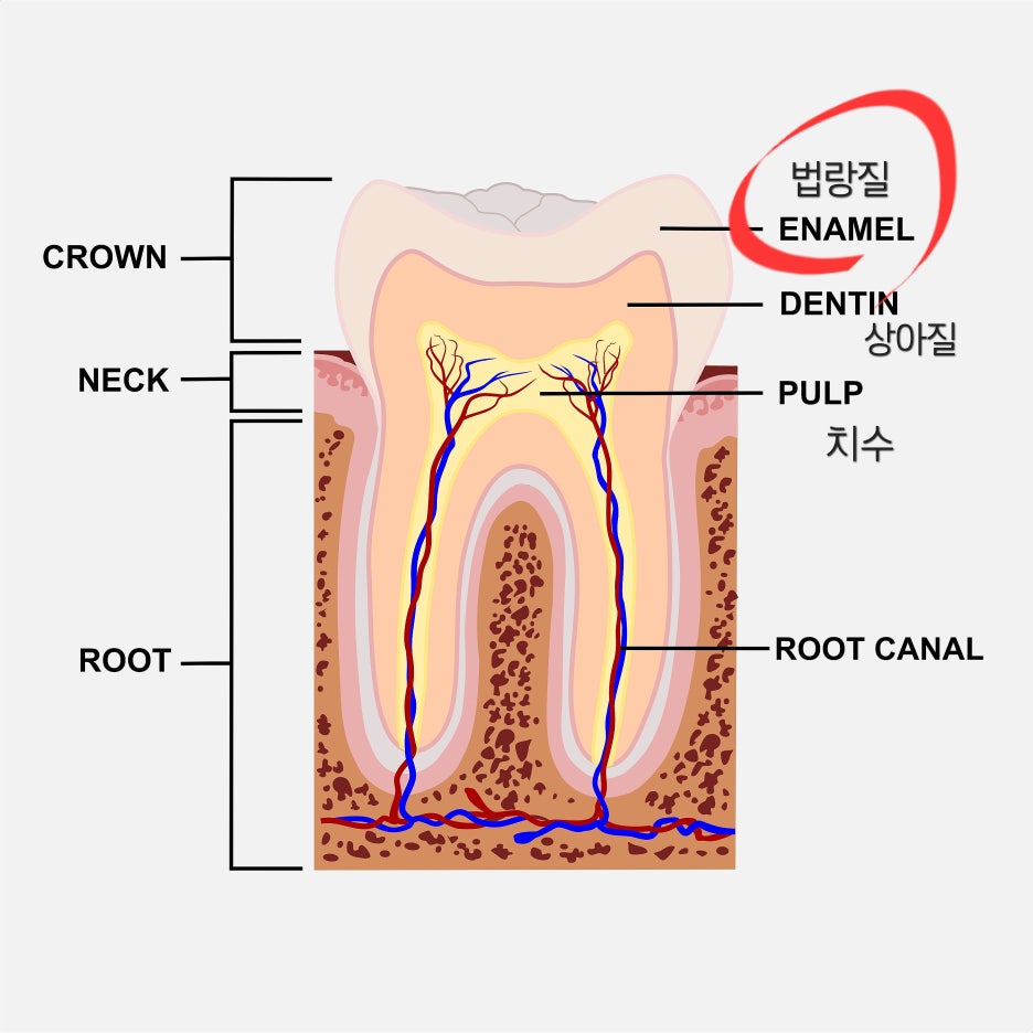 치아성형 종류, 비용, 장단점까지 완벽정리 관련 이미지 4