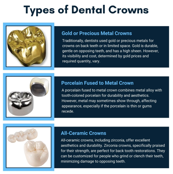 역삼동 크라운 치과 치료 필요한 치아상태, 꼭 확인하세요. 관련 이미지 7
