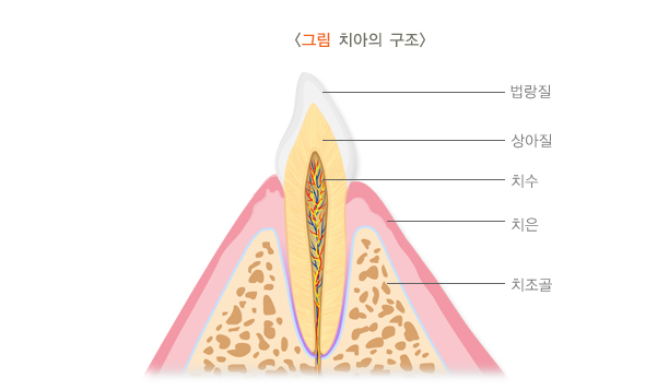 썩은앞니, 빠르게 치료하지 않으면 큰일 납니다 관련 이미지 6