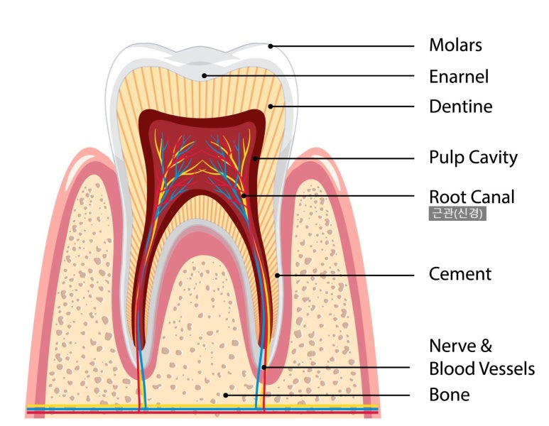 충치치료크라운 비용, 재료별 장단점까지 전부 공개 관련 이미지 2