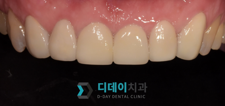 라미네이트종류, 이것만 확인하면 됩니다 관련 이미지 4