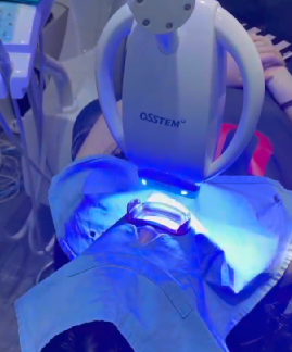 선릉역치아미백 리뷰 보기 전에 관련 이미지 5