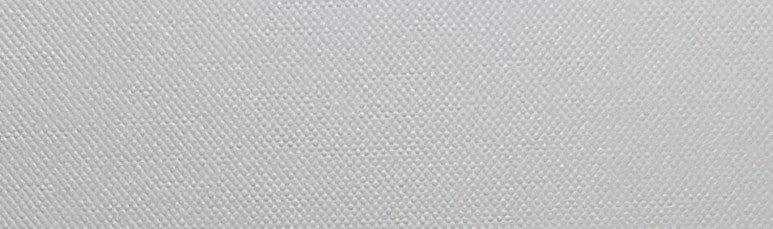 치아미백 vs 라미네이트, 누렁니 탈출하고 싶으신 분들만 관련 이미지 11