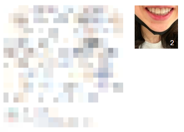 치과치아미백, 700명 이상이 디데이치과를 선택한 이유? 관련 이미지 6