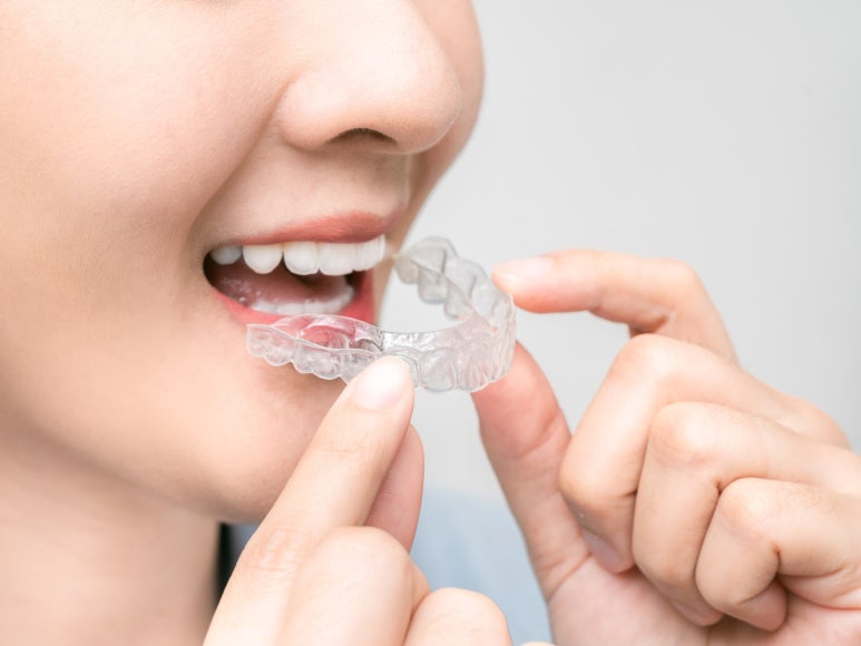 치아미백유지기간부터 종류, 주의사항까지 알려드립니다 관련 이미지 13