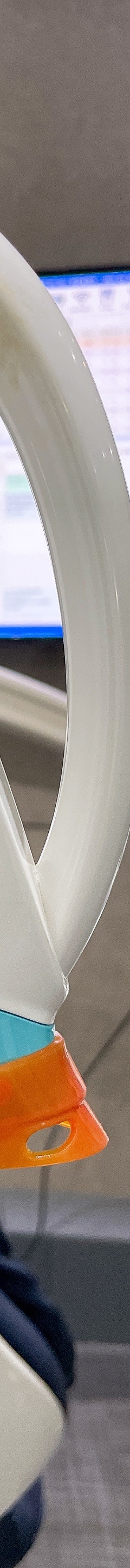 원데이 치과미백 치료? 5000건 해보고 알려드립니다. 관련 이미지 14