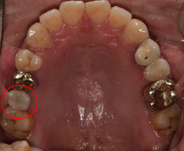 선릉역 임플란트? 관련 이미지 2