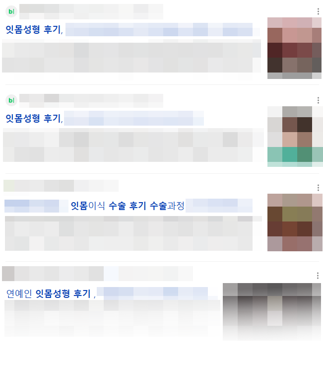 Gangnam Gum Contouring—Doesn’t It Hurt? An Honest Account of the Pain image 2