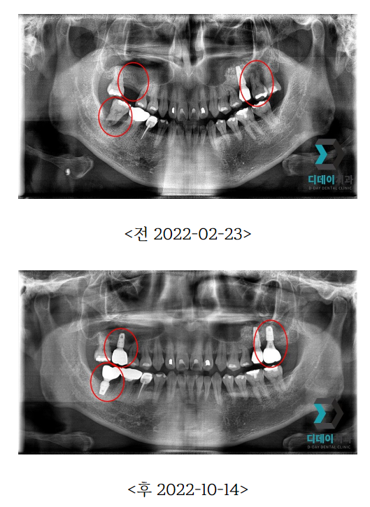 선릉역 치과, 후기만 보고 가면 안된다? 반드시 확인해봐야 할 3가지 관련 이미지 2