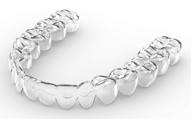 선릉 투명교정 시작 전, 반드시 확인할 체크리스트 관련 이미지 4