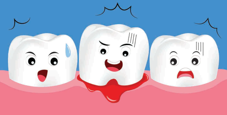 임플란트시술주의사항, 모르면 10년 못 쓰는 이유 관련 이미지 8