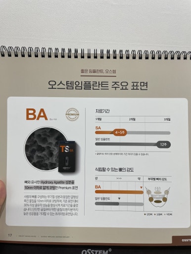 선릉역 근처에서 임플란트 할 치과를 찾고있다면 <필독> 관련 이미지 5