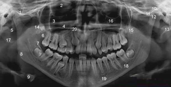 잇몸치료레이저, 받기 전 이것만은 꼭 확인하세요 관련 이미지 9