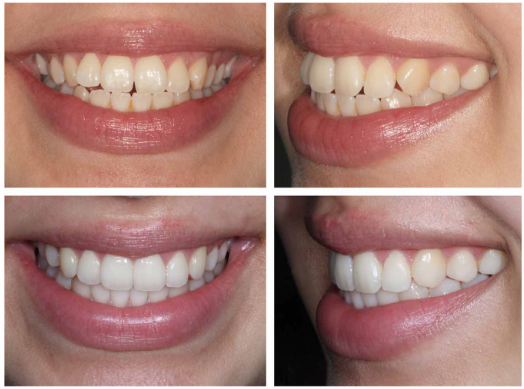 강남역치아교정, 관련 이미지 4