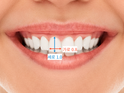 법랑질성형, 잇몸성형, 치아미백까지! 디데이치과 심미치료 총집합 치료사례 관련 이미지 4