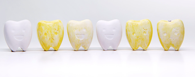 치아미백 지속기간,가격, 부작용, 횟수, 총정리 해드립니다. 관련 이미지 2