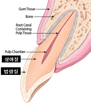 치아다듬기, 만만하게 생각할 치료는 절대 아닙니다. 관련 이미지 2