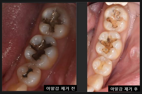 언주역치과, 의사 실력 모르겠다면? OO부터... 관련 이미지 3