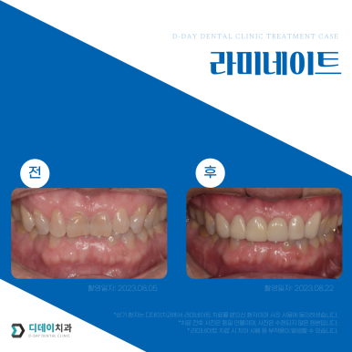 라미네이트비용 알아볼 때 관련 이미지 2
