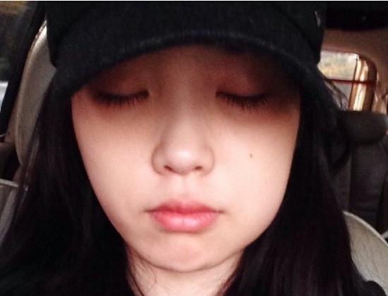 사랑니꼭뽑아야할까요? 발치 시 비용과 주의사항까지 알려드립니다. 관련 이미지 1