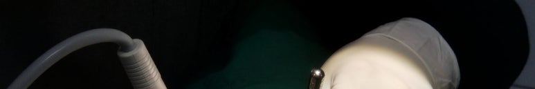 앞니뿌리충치, 치료과정 정리해드립니다. 관련 이미지 8