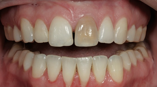 서울실활치미백, 일반 미백과 다른 이유 의사 작성 관련 이미지 3