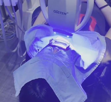 선릉역치과, 치아미백 후기보다 중요한 것 2가지 관련 이미지 6