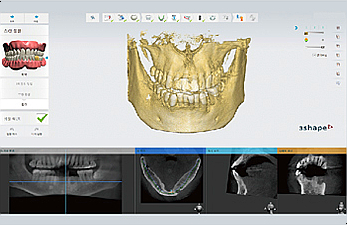 양재역 치과, 실력과 양심 두마리 토끼를 놓치지 않는 방법 관련 이미지 4