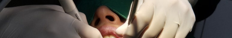 앞니뿌리충치, 치료과정 정리해드립니다. 관련 이미지 9