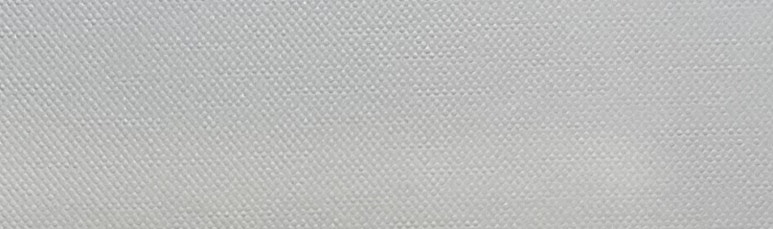 치아미백 vs 라미네이트, 누렁니 탈출하고 싶으신 분들만 관련 이미지 13