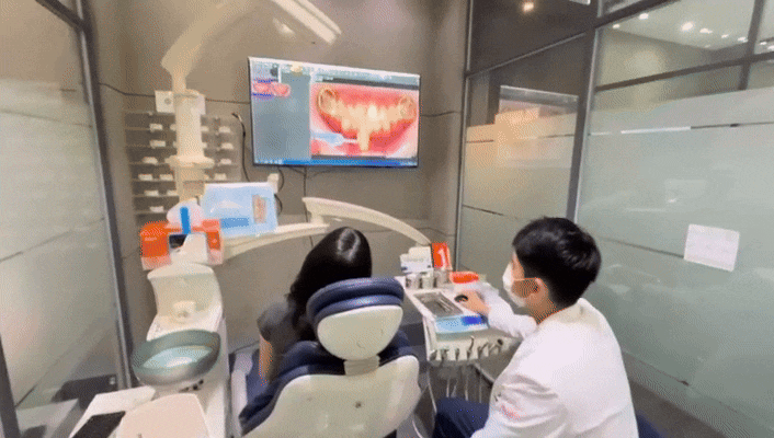 라미네이트 레진, 덤탱이를 피하려면 꼭 보세요 관련 이미지 5