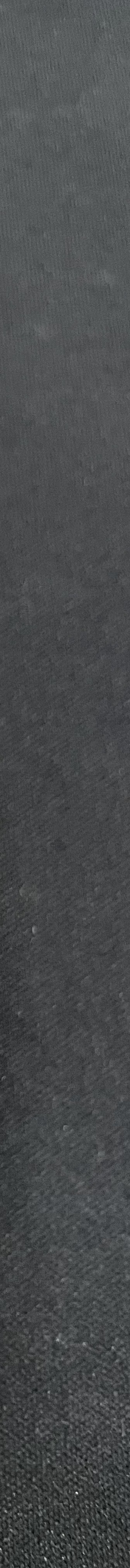 강남역 치과 임플란트 수면마취?해야만 하는 경우 관련 이미지 6