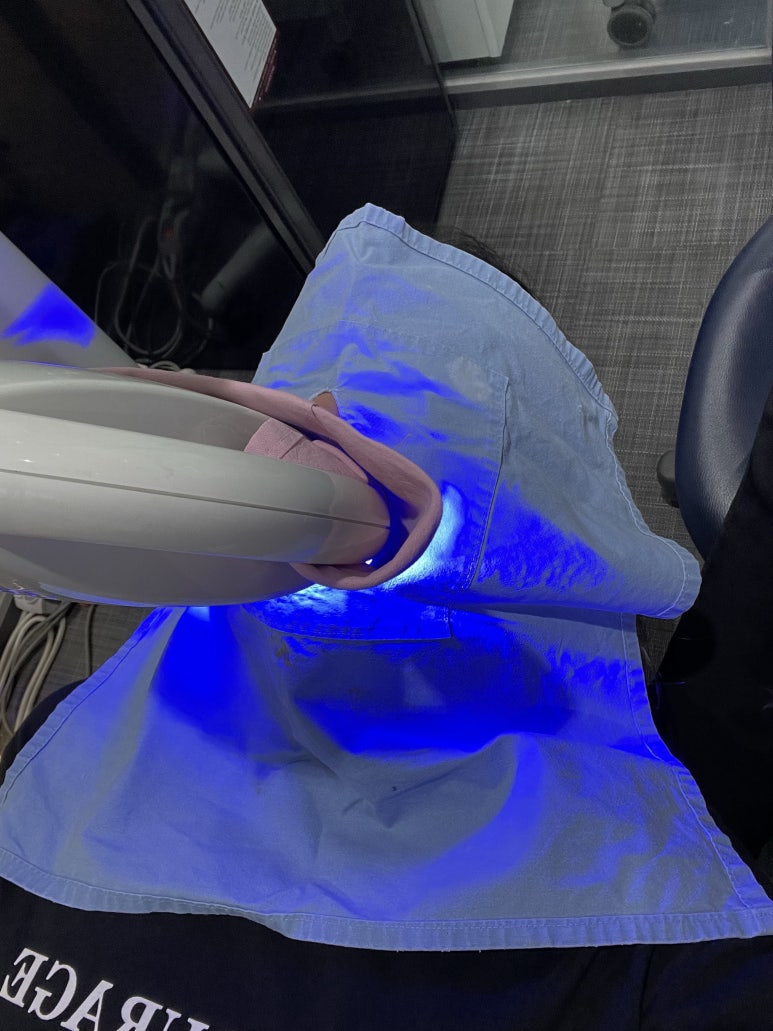 치과치아미백 #내돈내산 찐후기 (feat. 직원이 직접 받은 솔직후기) 관련 이미지 7