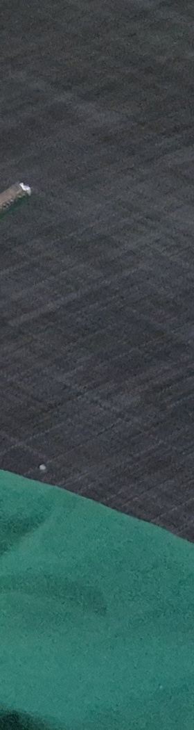 한티역치과 임플란트, 뼈이식 꼭 해야 할까? <의사 답변> 관련 이미지 16