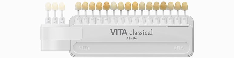 강남치아미백, 금세 또 착색되는 이유와 원데이 치료사례 관련 이미지 1