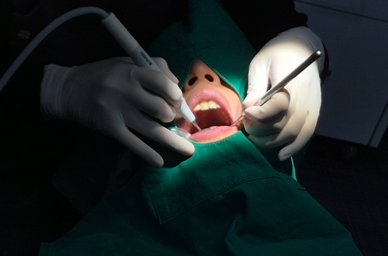 레진인레이차이, 실패하지 않으려면 이 2가지만 확인하세요 관련 이미지 10