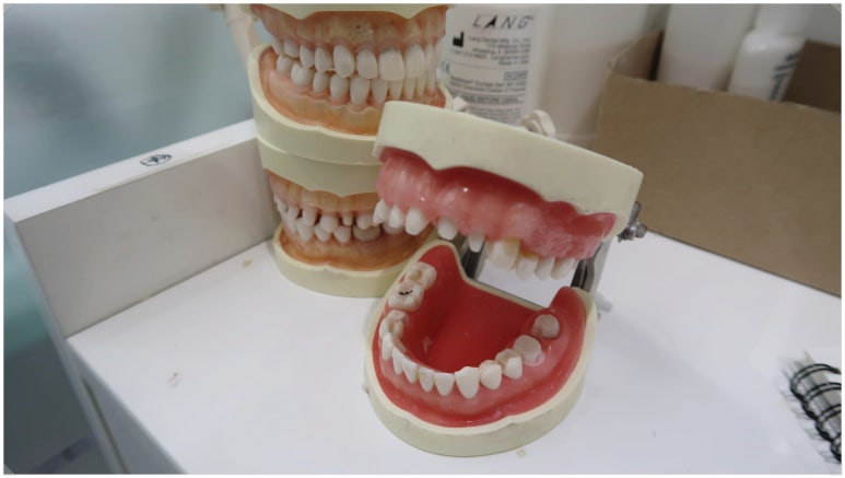 충치치료고통...힘드신 분들께 의사가 드리는 이야기 관련 이미지 4