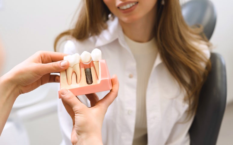 임플란트영구? 내 치아처럼 수명 늘리고 싶다면 필독 관련 이미지 4