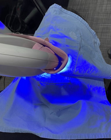 미백치약효과, 진짜 있을까? 치과의사가 전부 설명드립니다. 관련 이미지 4