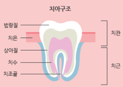 서초 치과, 충치 치료의 핵심은? 관련 이미지 2