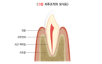 교대역치과 잇몸이 내려가서 뿌리가 보인다면, 지금 이 순간이 골든타임입니다 관련 이미지 3